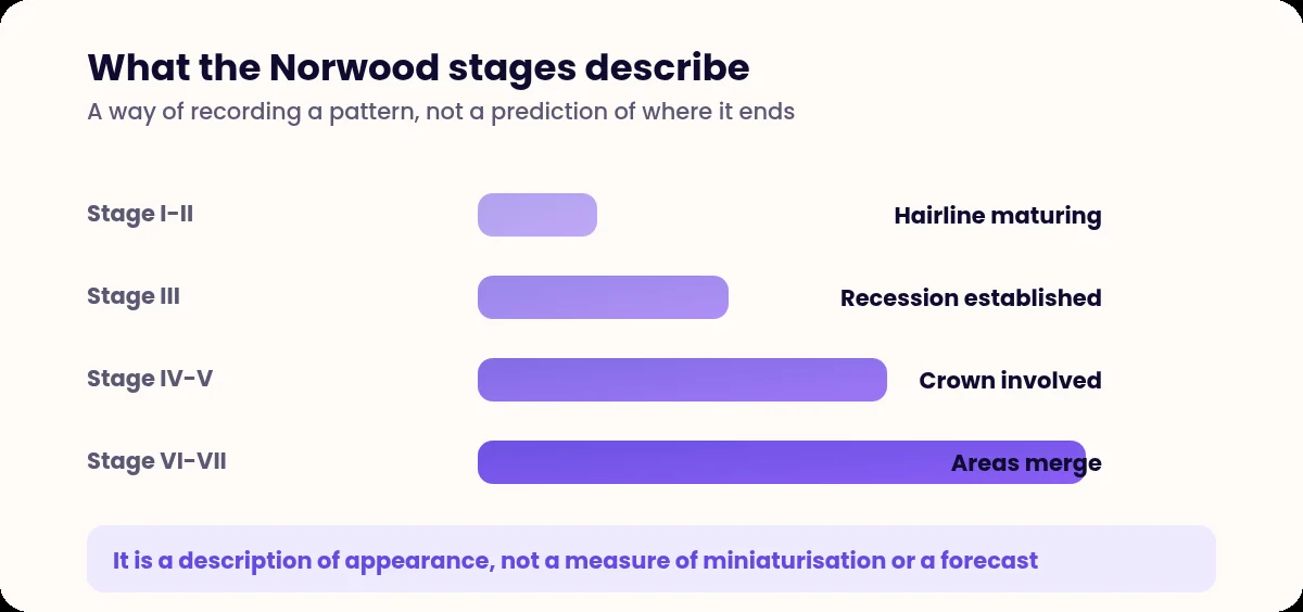 Bar chart of the Norwood stages of male pattern hair loss